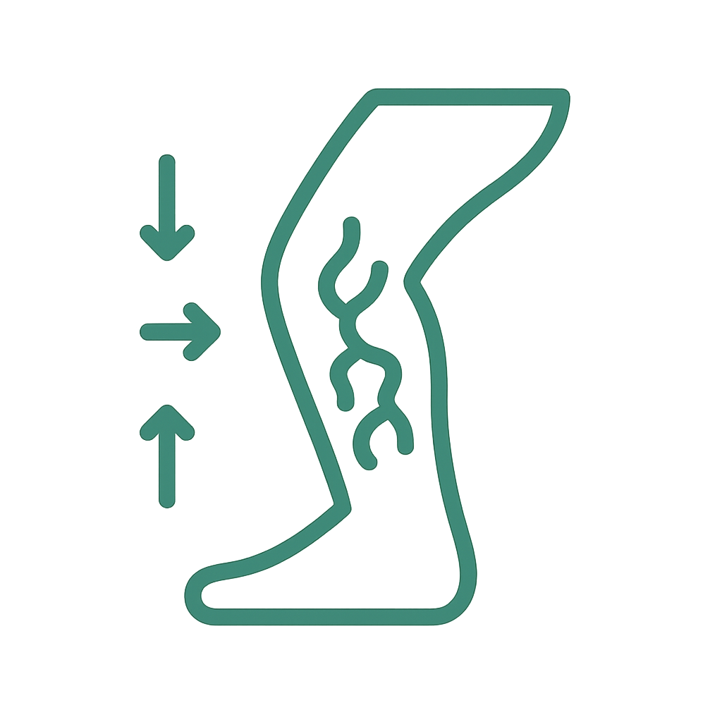 Varicose Veins